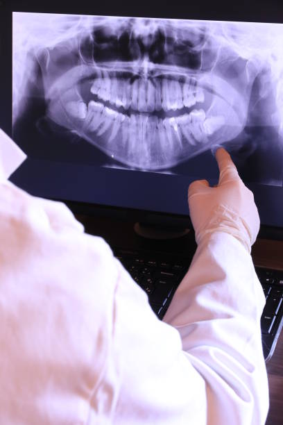Best Emergency Tooth Extraction in Washburn, ND