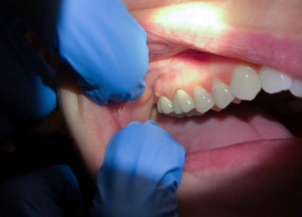 Best Weekend Emergency Dentist in Washburn, ND